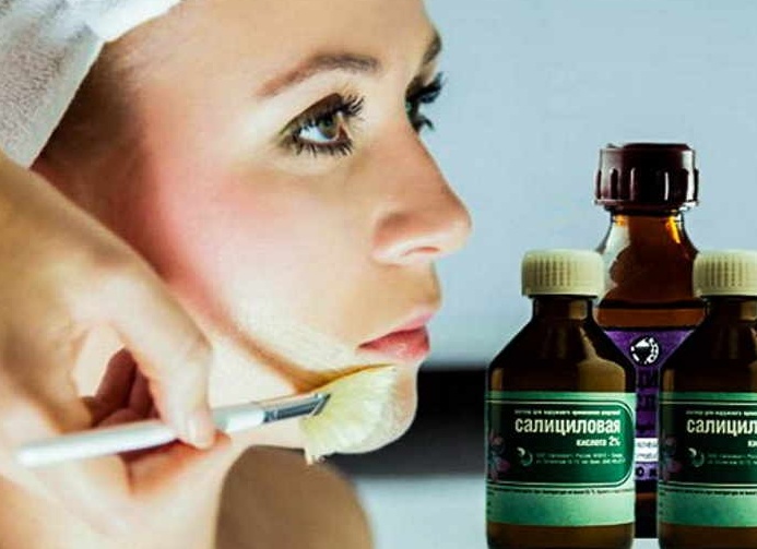 Салициловый пилинг: омоложение без пластических операций