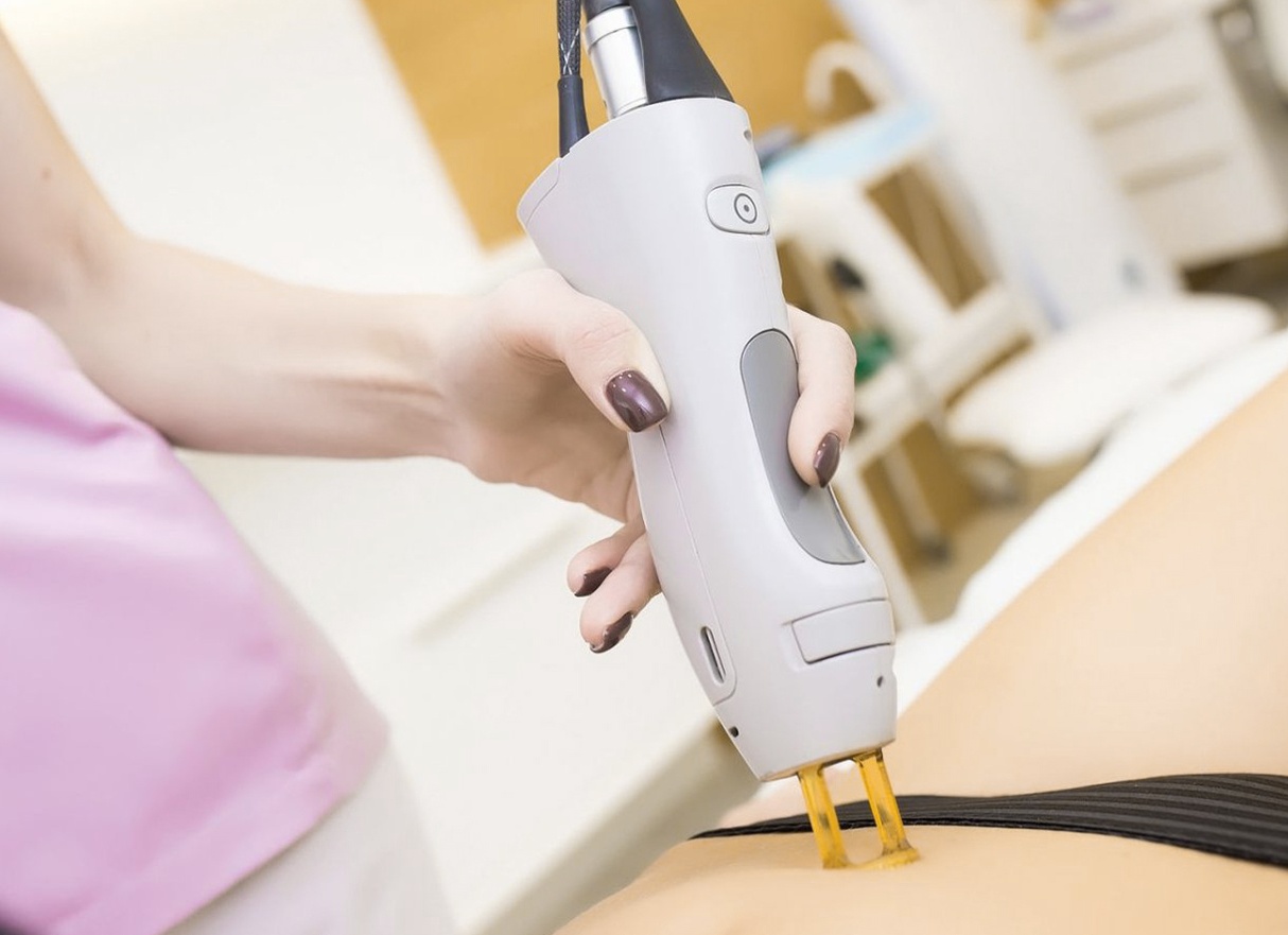 Преимущества лазеров Candela для разных типов кожи