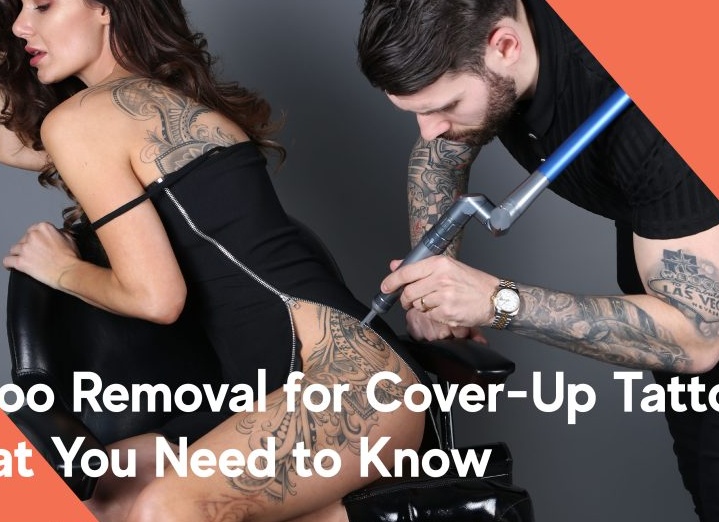 Удаление татуировок лазером: что нужно знать