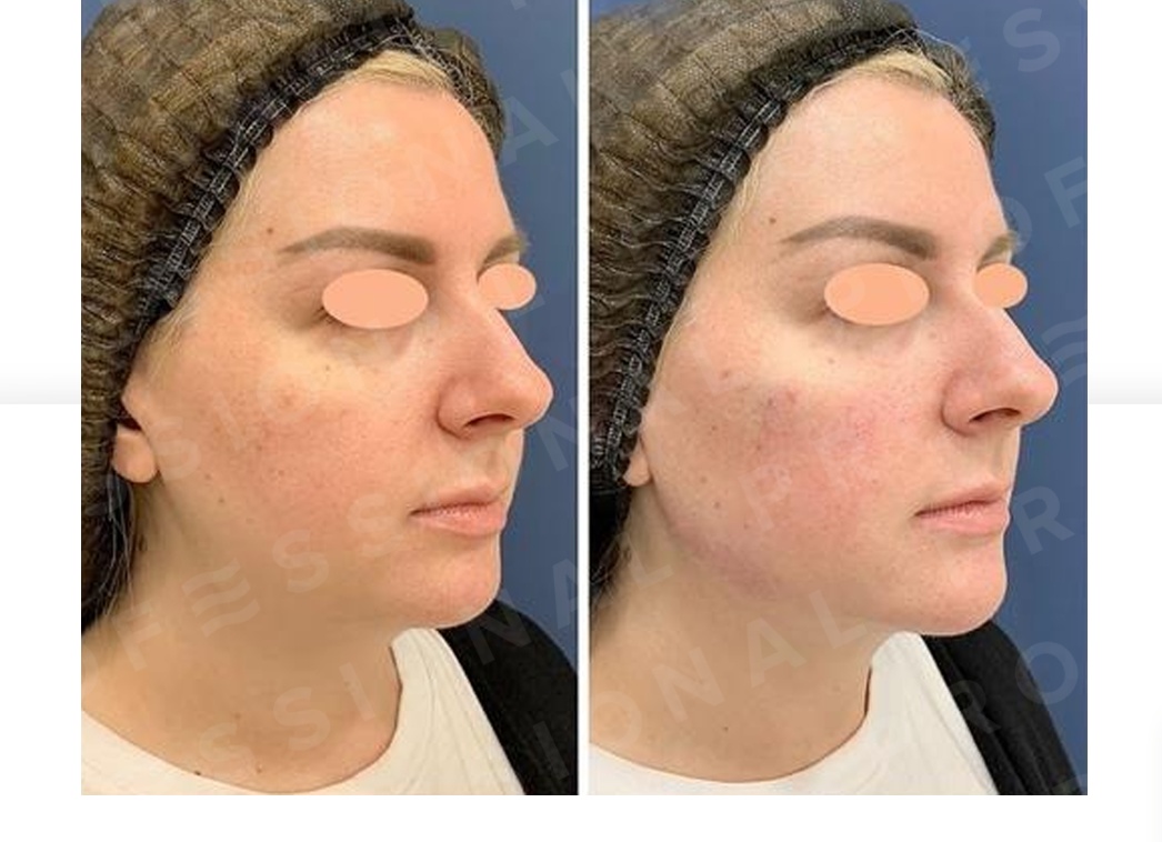 Моделирование лица – что это такое?