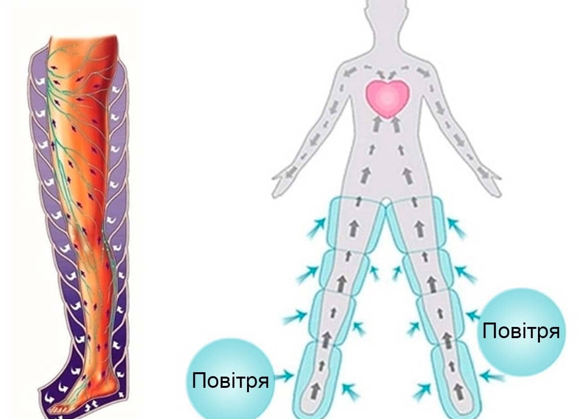 Польза прессотерапии для здоровья и фигуры