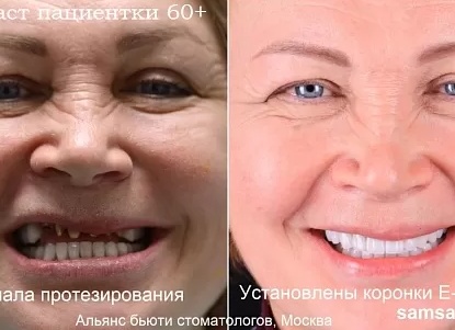 Секреты молодости: как вернуть коже лица свежий и упругий вид