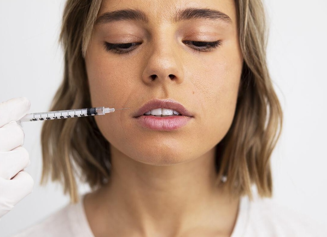 Как появляются носогубные складки + лучшие процедуры против них