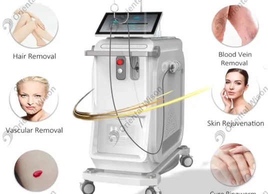 Обзор лучших аппаратов для устранения гиперпигментации