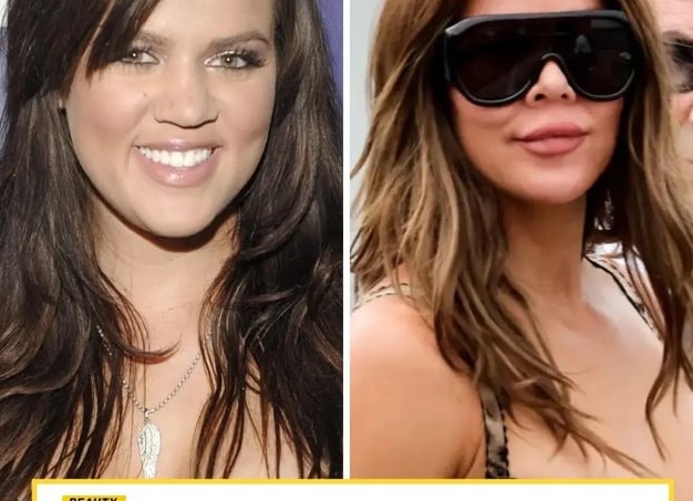 Рассказываем о трендах в пластике. Самые популярные операции за прошедший год.