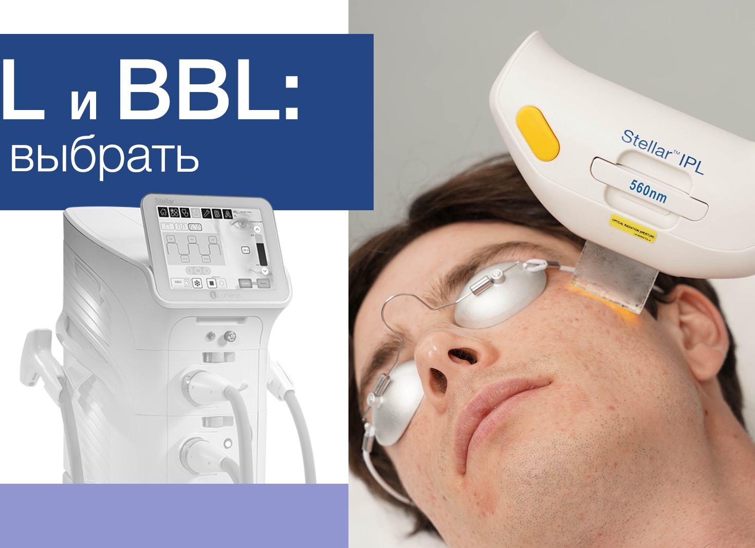 Что выбрать - Sciton BBL или Lumenis M22?