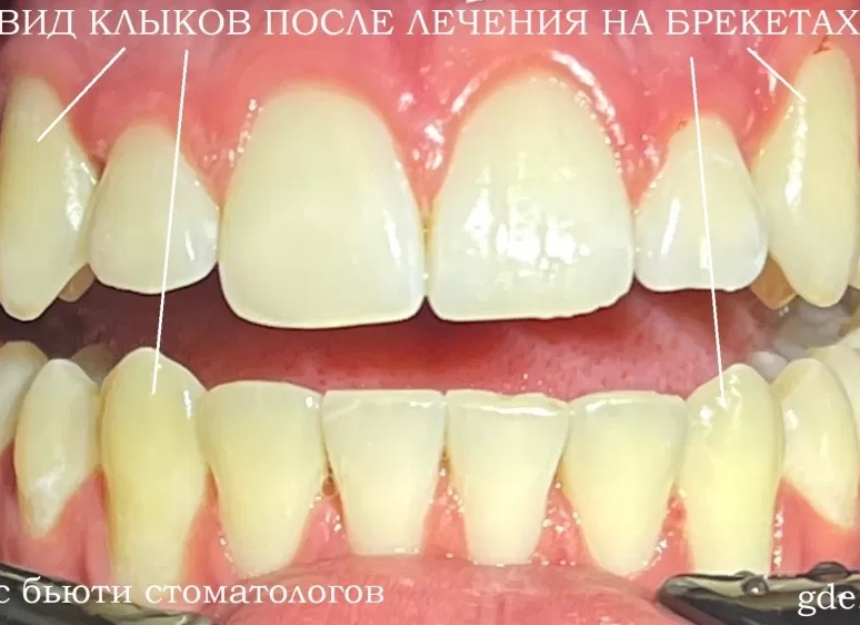 Косметологический комбайн: зачем нужен, как выбрать, топ-3 лучших