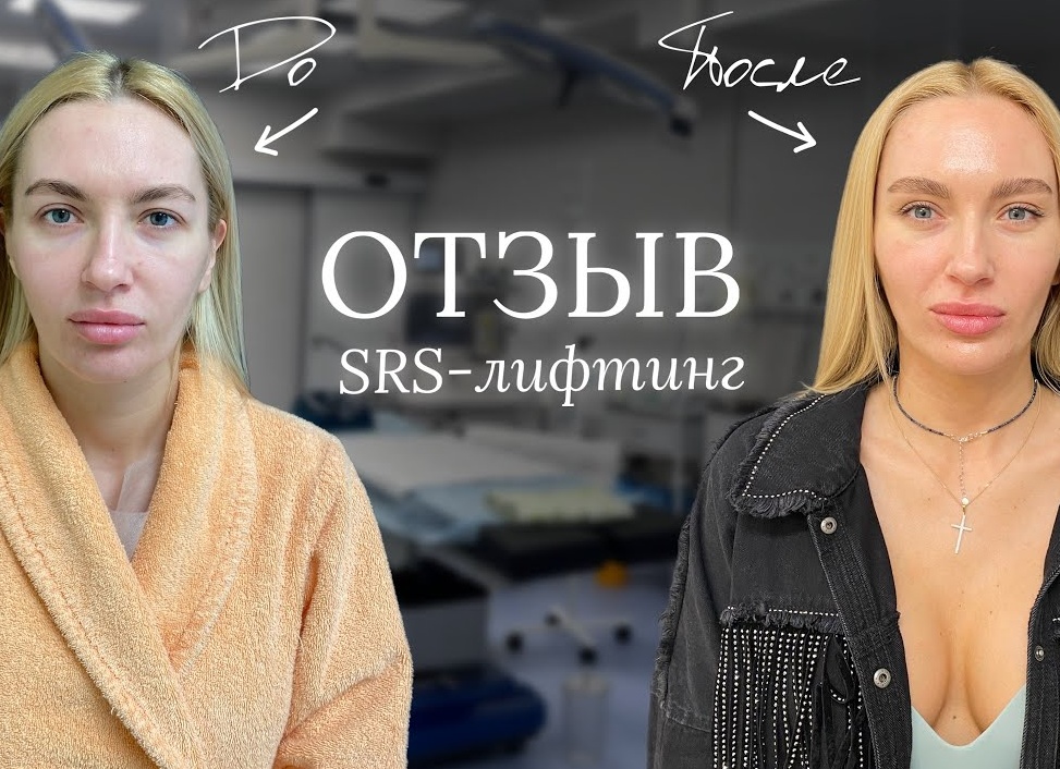 От первого лица: результаты SRS-лифтинга