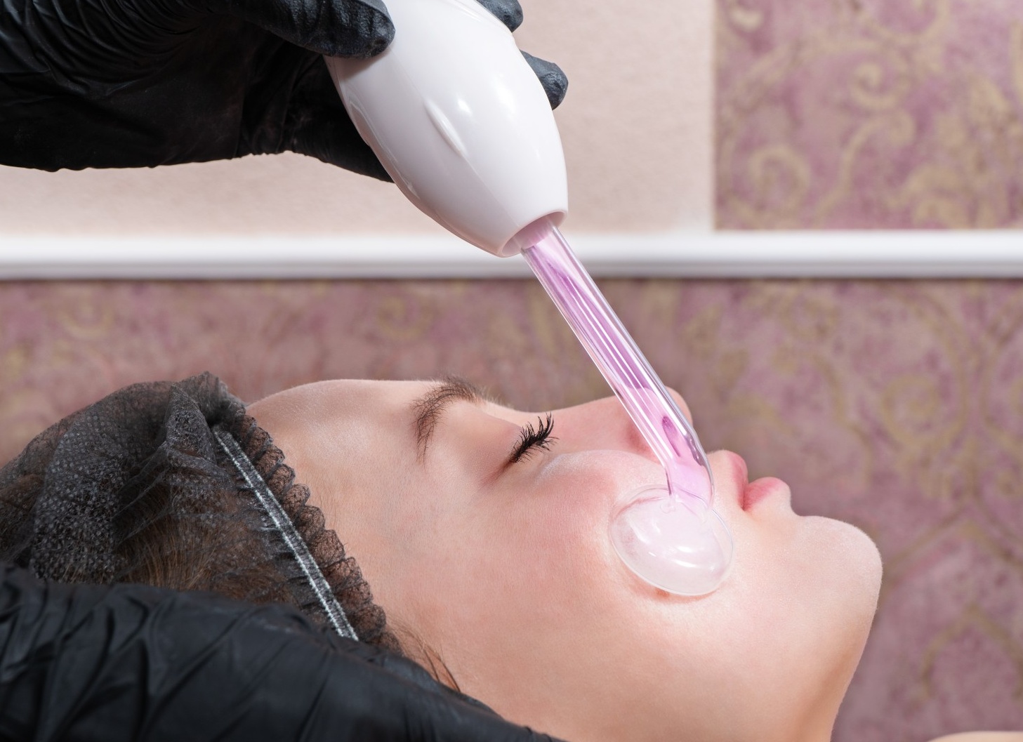 Топ-5 видов пилингов